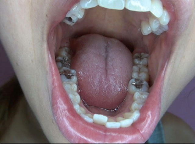 GA-300 パート 13 - 78 分