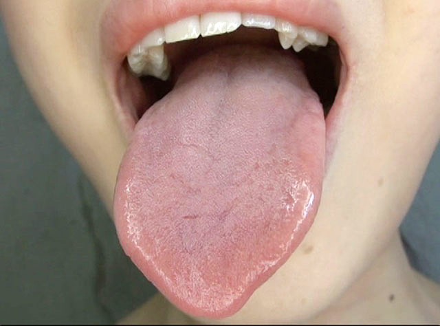 GA-300 パート 14 - 82 分