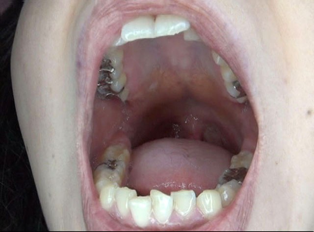 GA-300 パート 15 - 86 分