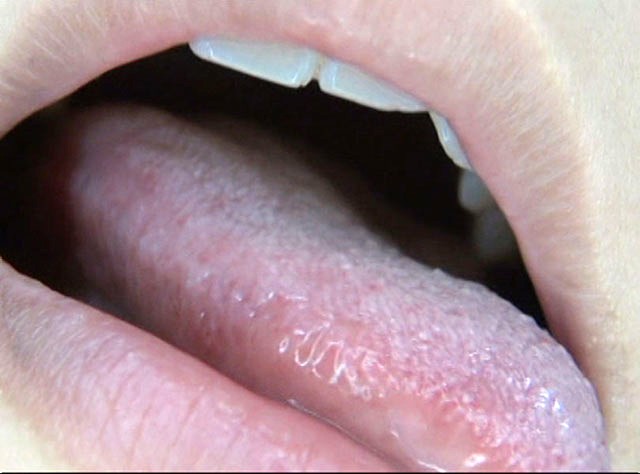 GA-300 パート 18 - 98 分