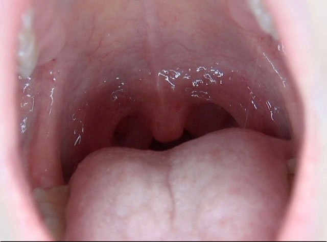 GA-300 パート 19 - 102 分