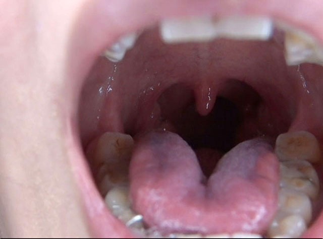 GA-300 パート 20 - 106 分