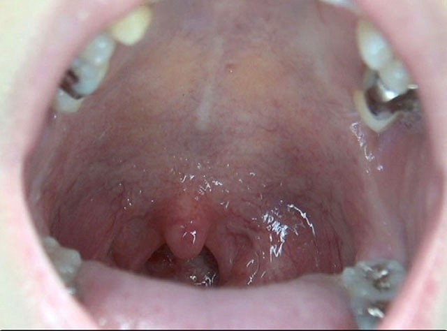 GA-300 パート 3 - 38 分