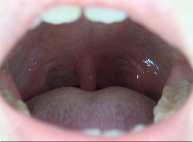 GA-300 パート 4 - 42 分