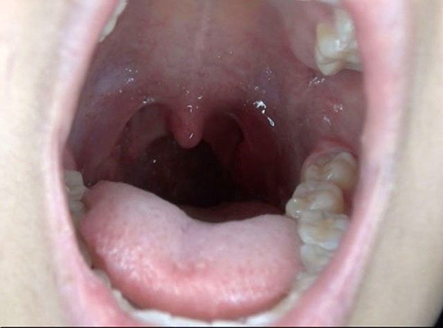 GA-300 パート 9 - 62 分