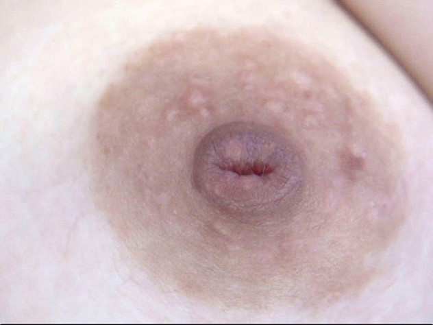 GA-304 Part 13 - 78 minutes