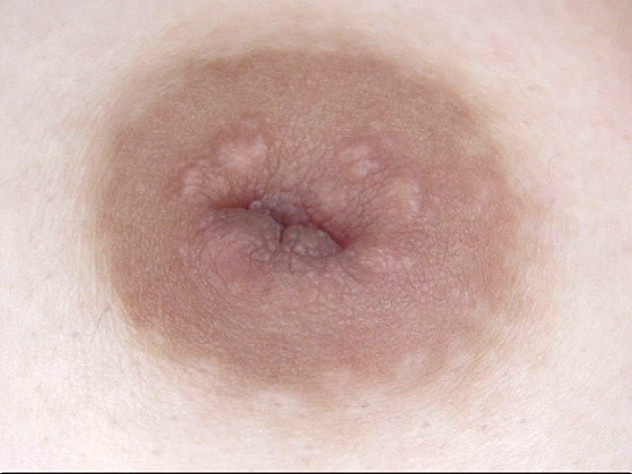 GA-304 第 16 部分 - 90 分钟