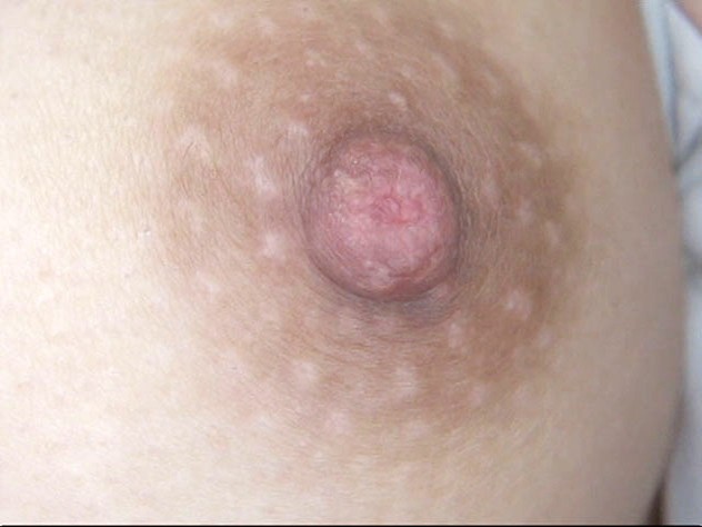 GA-304 Part 20 - 106 minutes