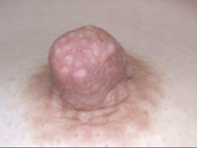 GA-304 第 4 部分 - 42 分钟