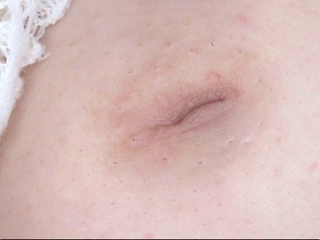 GA-304 第 6 部分 - 50 分钟