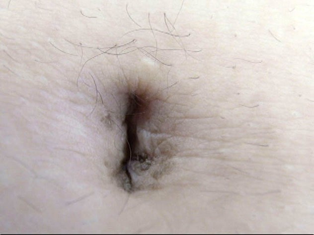 GA-305 Part 11 - 70 minutes