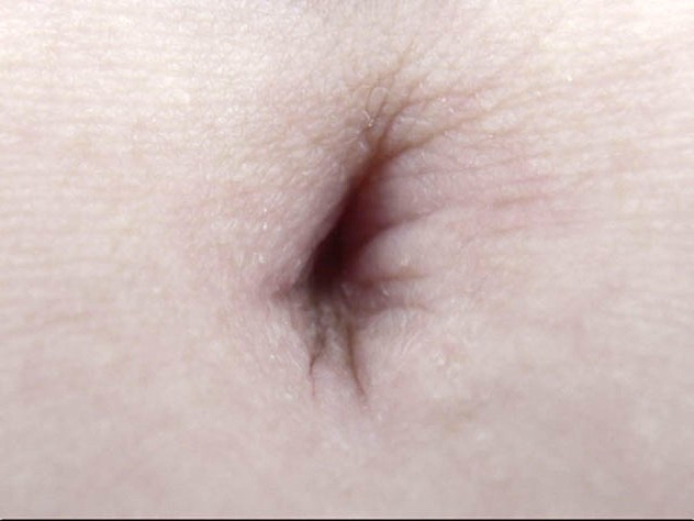 GA-305 第 14 部分 - 82 分钟