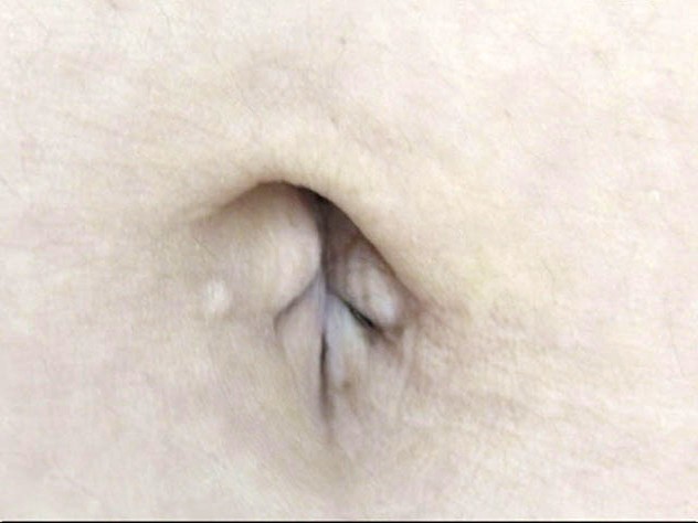 GA-305 Part 15 - 86 minutes