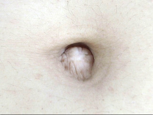 GA-305 第 17 部分 - 94 分钟