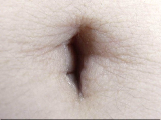 GA-305 第 18 部分 - 98 分钟