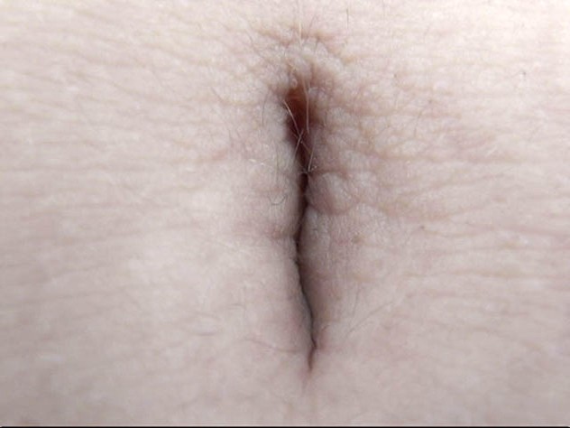 GA-305 Part 19 - 102 minutes