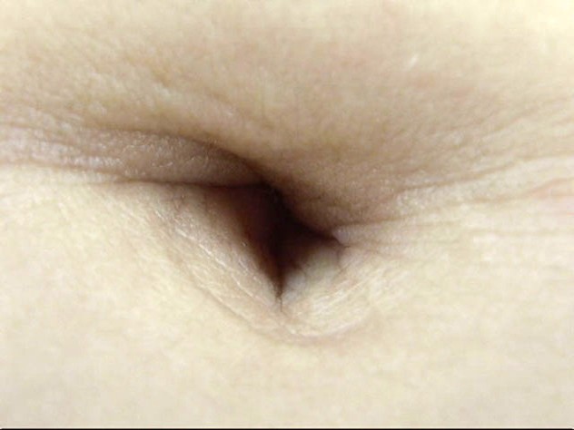 GA-305 Part 20 - 106 minutes