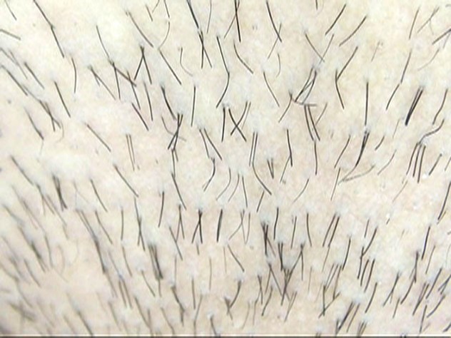 GA-306 第 1 部分 - 30 分钟