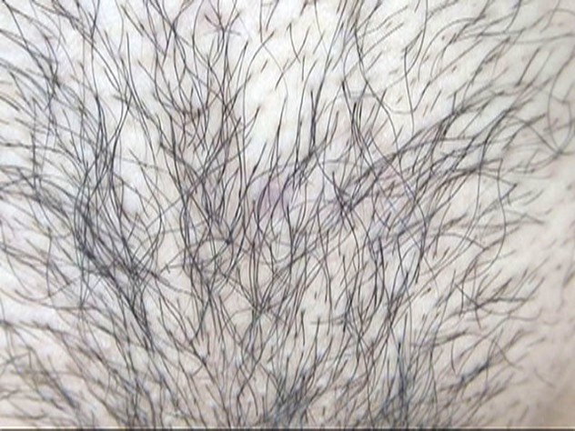 GA-306 第 3 部分 - 38 分钟