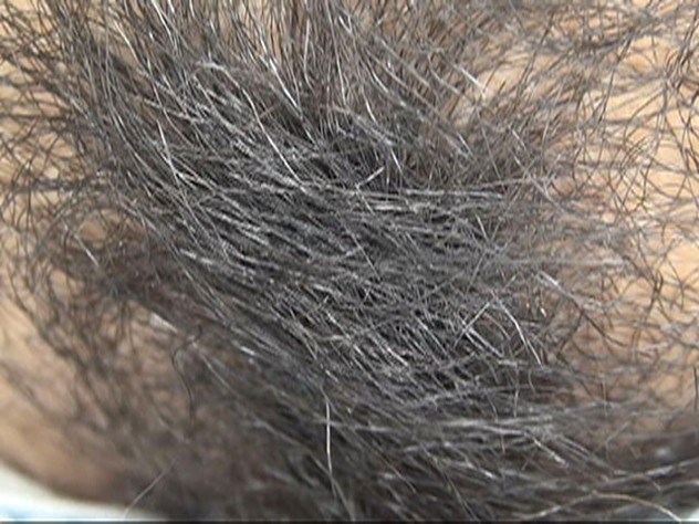 GA-306 第 4 部分 - 42 分钟