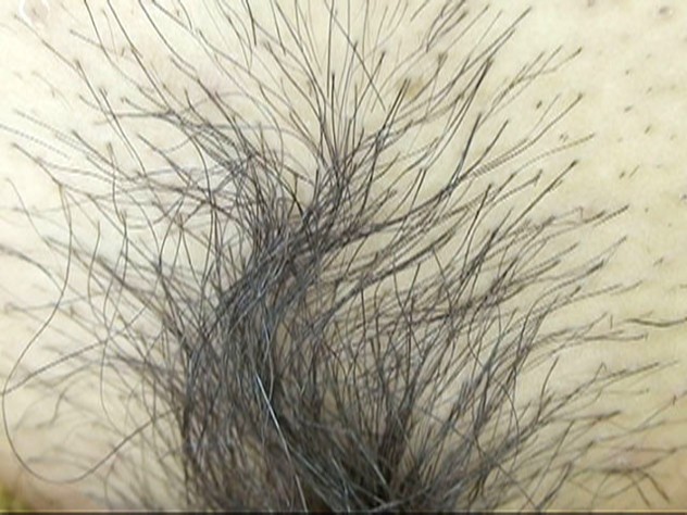 GA-306 第 7 部分 - 54 分钟