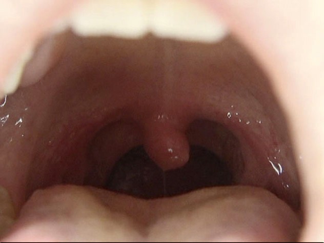 GA-312 Part 1 - 30 minutes