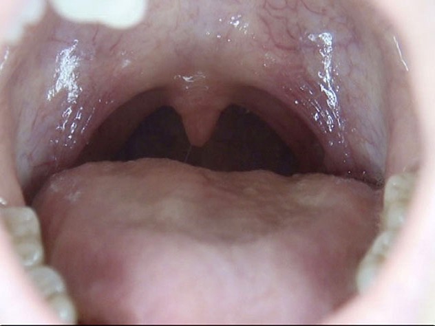 GA-312 Part 10 - 66 minutes