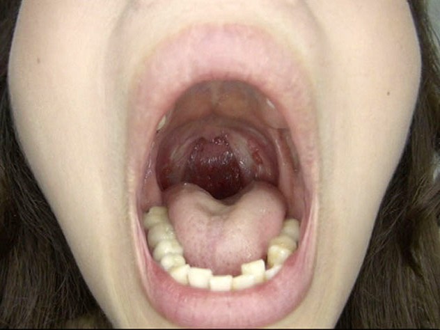 GA-312 Part 12 - 74 minutes