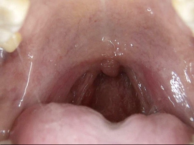 GA-312 Part 13 - 78 minutes