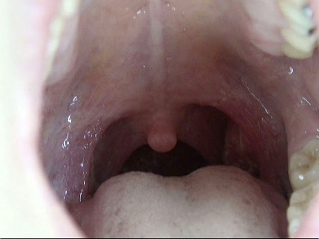 GA-312 Part 14 - 82 minutes