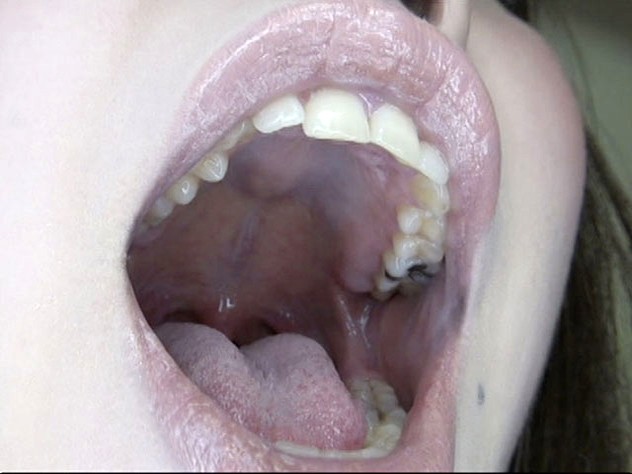 GA-312 Part 15 - 86 minutes