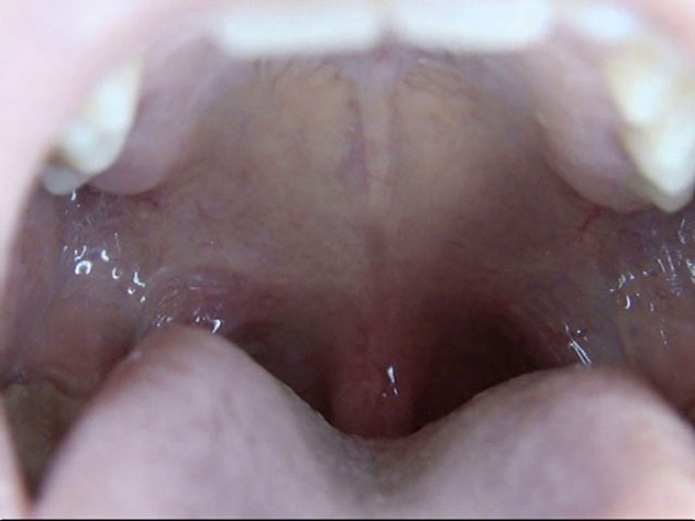 GA-312 Part 16 - 90 minutes