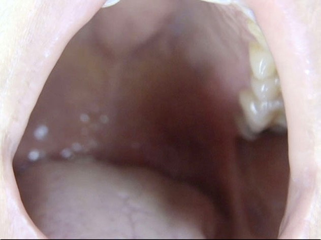 GA-312 Part 17 - 94 minutes