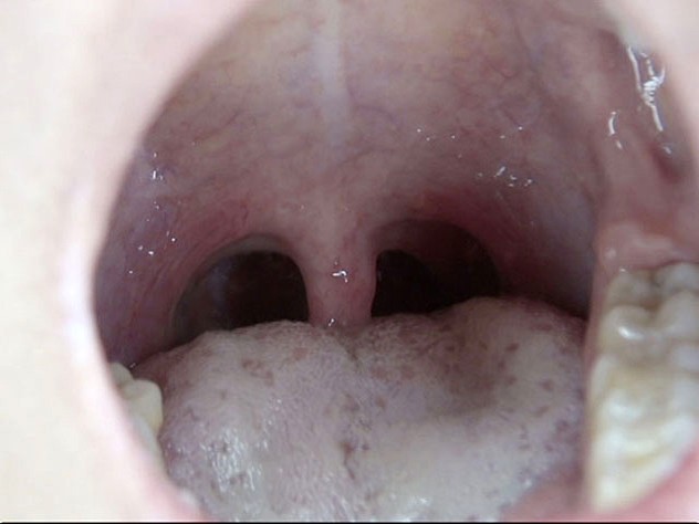 GA-312 Part 18 - 98 minutes