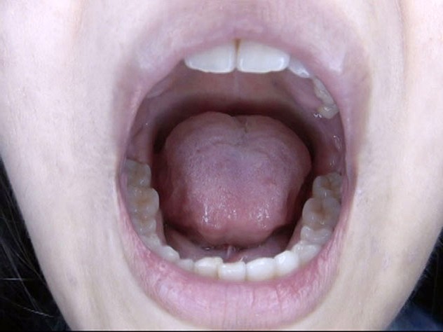 GA-312 Part 19 - 102 minutes