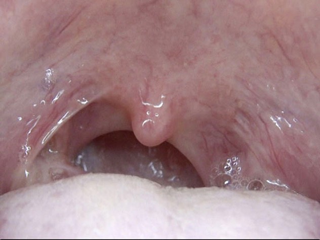 GA-312 Part 2 - 34 minutes