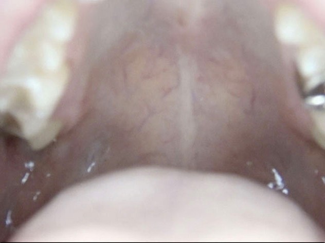 GA-312 Part 20 - 106 minutes