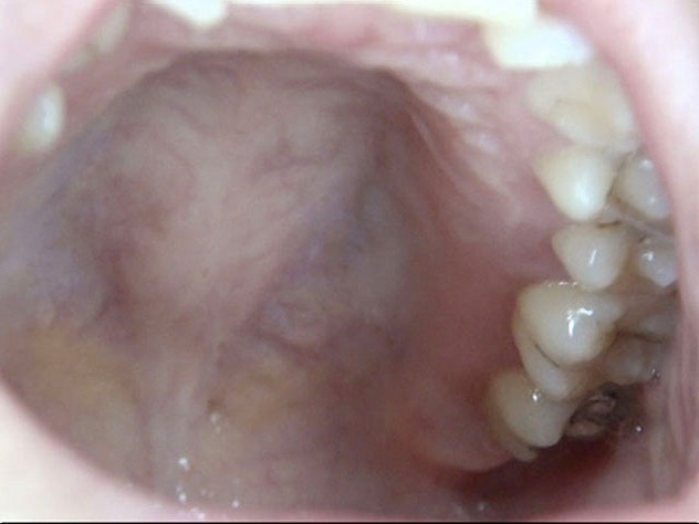 GA-312 Part 3 - 38 minutes