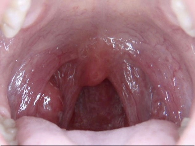 GA-312 Part 4 - 42 minutes