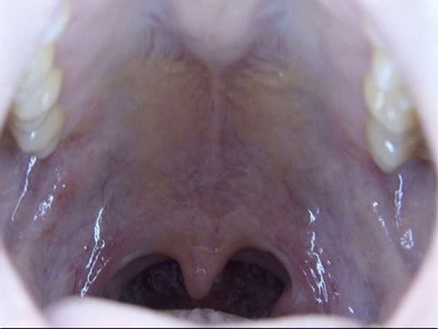 GA-312 Part 5 - 46 minutes