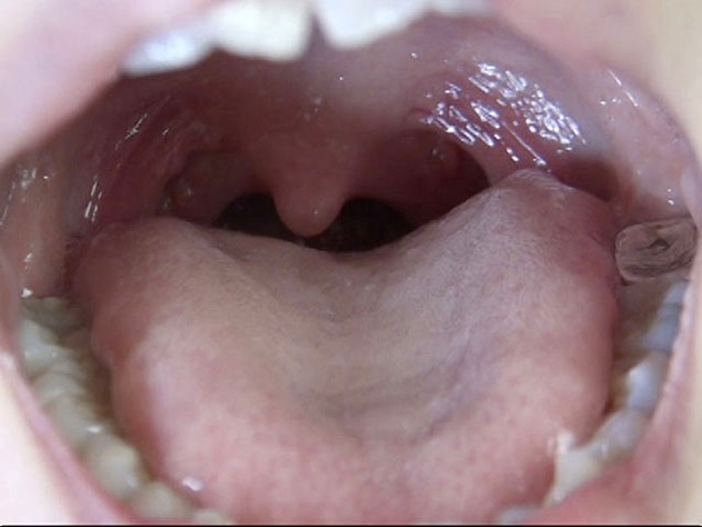 GA-312 Part 6 - 50 minutes