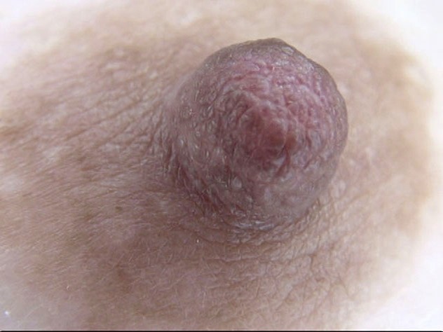 GA-313 第 1 部分 - 30 分钟