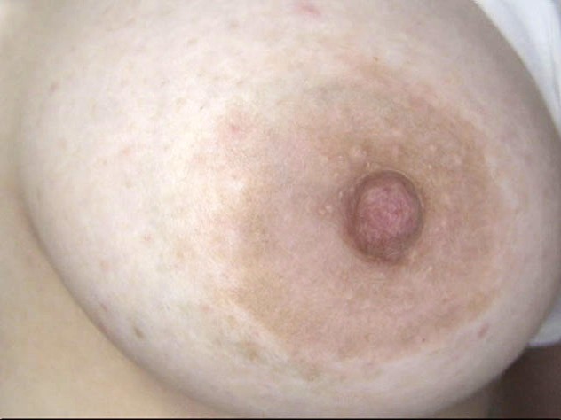 GA-313 第 11 部分 - 70 分钟