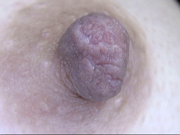 GA-313 第 13 部分 - 78 分钟