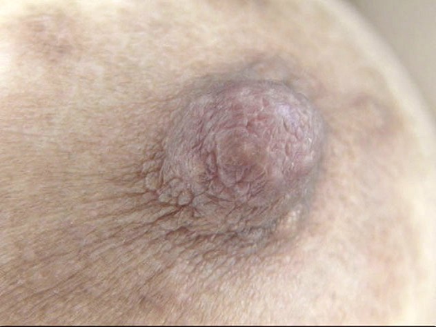 GA-313 第 2 部分 - 34 分钟