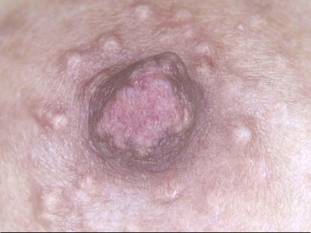 GA-313 第 9 部分 - 62 分钟