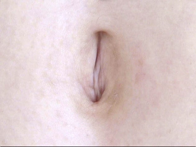 GA-314 パート 1 - 30 分