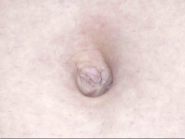 GA-314 Bagian 12 - 74 minit