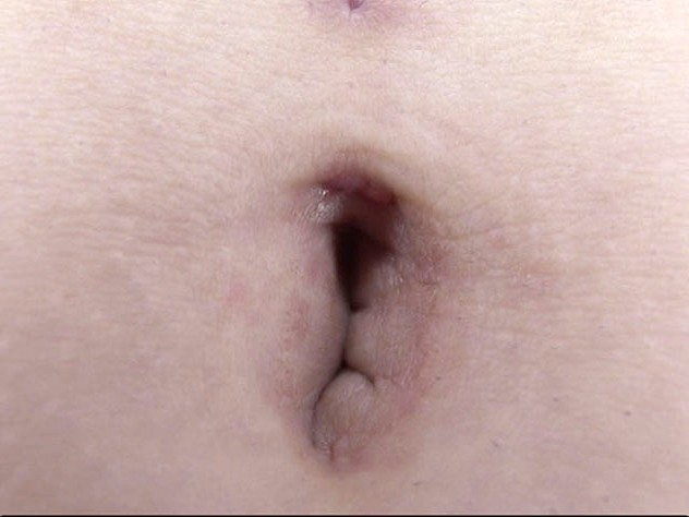 GA-314 Bagian 13 - 78 minit