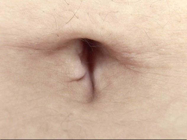 GA-314 パート 14 - 82 分